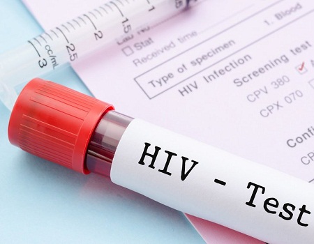 Nyanza still leading in HIV rates, Study reveals